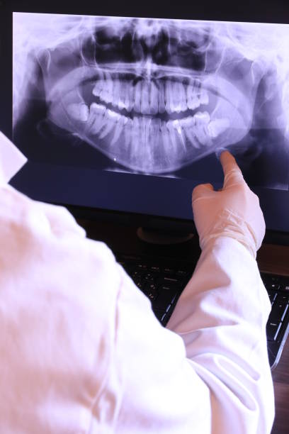 Best Emergency Broken Tooth Repair in Spokane, WA